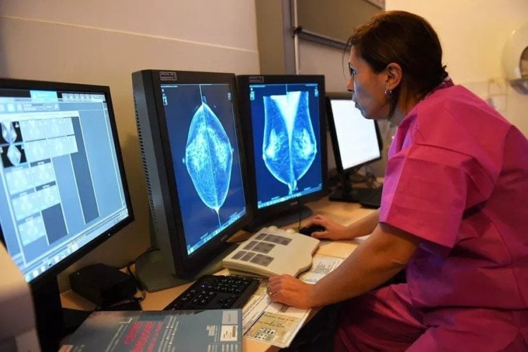 Google AI to study breast cancer